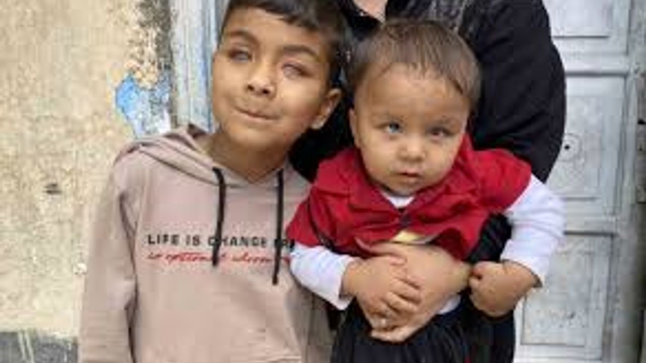 Tedaviyle dünyanın renklerini ilk defa gören 2 kardeş, başka hastalara da umut oldu