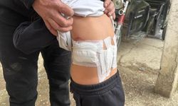 Eşeğin ısırması ve tekmelemesi sonrası ağır yaralanan çocuk hastaneye kaldırıldı