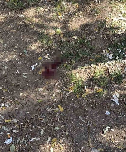 Parkta bir kişiyi döner bıçağıyla yaralayan saldırgan yakalandı