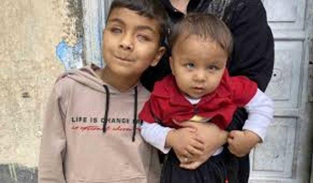 Tedaviyle dünyanın renklerini ilk defa gören 2 kardeş, başka hastalara da umut oldu