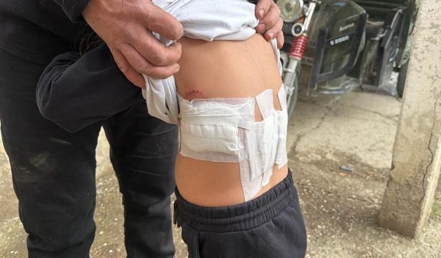 Eşeğin ısırması ve tekmelemesi sonrası ağır yaralanan çocuk hastaneye kaldırıldı