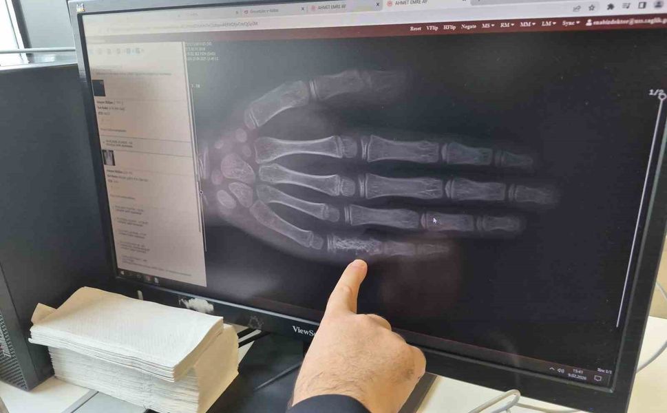 Eskişehir'de her ay 5 ila 7 çocuğa kanser tanısı konuluyor