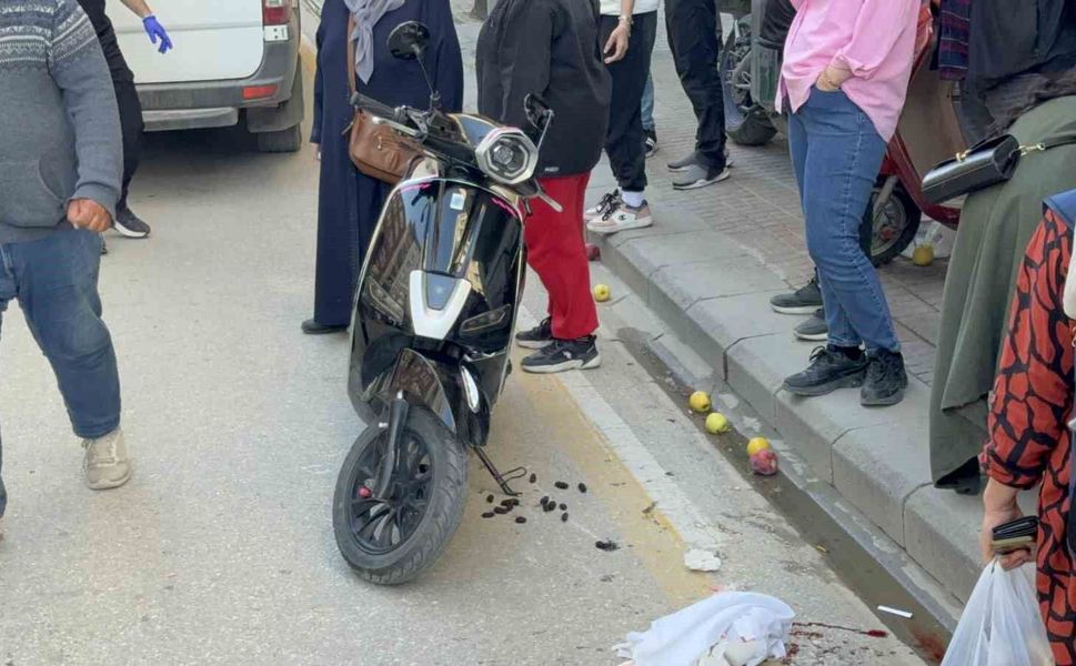 Scooterin çarptığı yaya yaralandı