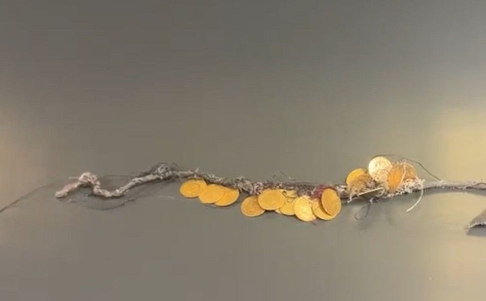 Kadının boynundaki 185 bin TL değerindeki 17 çeyrek altın böyle çalındı