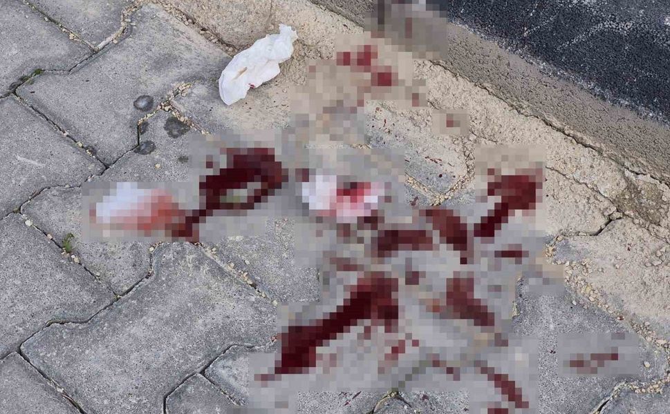 16 yaşındaki çocuk caddede bacağından bıçaklandı