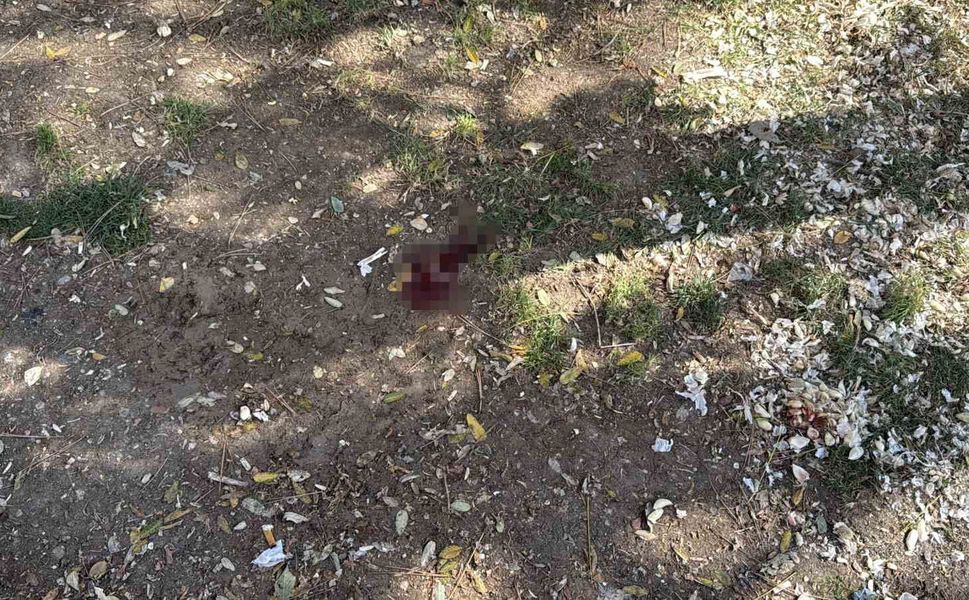 Parkta bir kişiyi döner bıçağıyla yaralayan saldırgan yakalandı
